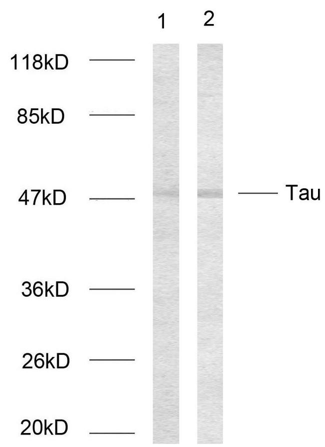 MAPT / Tau Antibody - Western blot analysis of lysates from HeLa cells, using Tau Antibody. The lane on the right is blocked with the synthesized peptide.