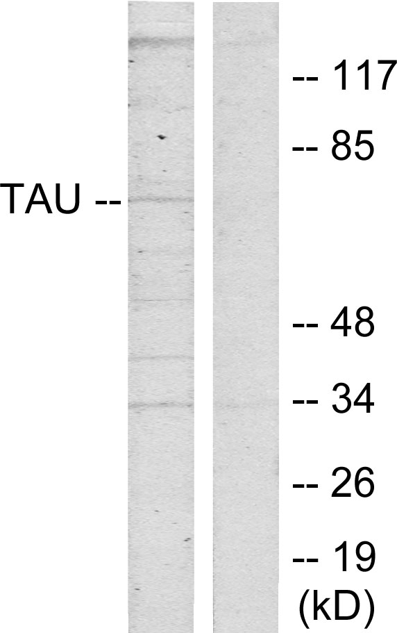 MAPT / Tau Antibody - Western blot analysis of lysates from HeLa cells, using Tau Antibody. The lane on the right is blocked with the synthesized peptide.
