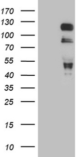 MAPT / Tau Antibody - HEK293T cells were transfected with the pCMV6-ENTRY control. (Left lane) or pCMV6-ENTRY MAPT. (Right lane) cDNA for 48 hrs and lysed