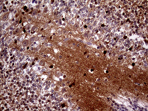 MAPT / Tau Antibody - Immunohistochemical staining of paraffin-embedded Human embryonic cerebellum within the normal limits using anti-MAPT mouse monoclonal antibody. (Heat-induced epitope retrieval by 1mM EDTA in 10mM Tris buffer. (pH8.5) at 120 oC for 3 min. (1:500)