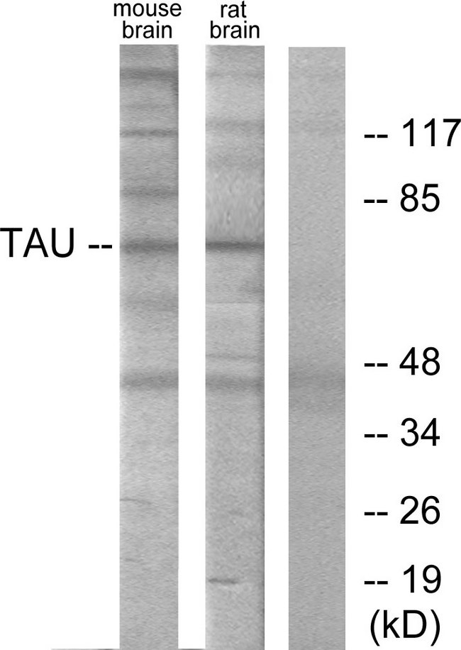 MAPT / Tau Antibody - Western blot analysis of lysates from mouse brain and Rat brain cells, using Tau Antibody. The lane on the right is blocked with the synthesized peptide.
