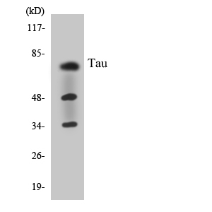 MAPT / Tau Antibody - Western blot analysis of the lysates from COLO205 cells using Tau antibody.