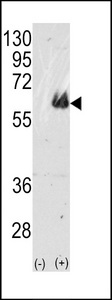 MAPT / Tau Antibody - Western blot of TAU(arrow) using rabbit polyclonal TAU Antibody. 293 cell lysates (2 ug/lane) either nontransfected (Lane 1) or transiently transfected with the TAU gene (Lane 2) (Origene Technologies).