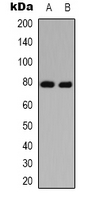MAPT / Tau Antibody - Western blot analysis of TAU (AcK686) expression in HeLa (A); HEK293T (B) whole cell lysates.
