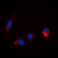 MAPT / Tau Antibody - Immunofluorescent analysis of TAU (pS356) staining in HeLa cells. Formalin-fixed cells were permeabilized with 0.1% Triton X-100 in TBS for 5-10 minutes and blocked with 3% BSA-PBS for 30 minutes at room temperature. Cells were probed with the primary antibody in 3% BSA-PBS and incubated overnight at 4 deg C in a humidified chamber. Cells were washed with PBST and incubated with a DyLight 594-conjugated secondary antibody (red) in PBS at room temperature in the dark. DAPI was used to stain the cell nuclei (blue).