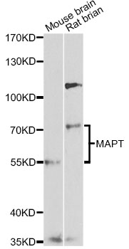MAPT / Tau Antibody - Western blot analysis of extracts of various cell lines, using MAPT antibody at 1:1000 dilution. The secondary antibody used was an HRP Goat Anti-Rabbit IgG (H+L) at 1:10000 dilution. Lysates were loaded 25ug per lane and 3% nonfat dry milk in TBST was used for blocking. An ECL Kit was used for detection and the exposure time was 90s.