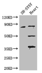MAPT / Tau Antibody - Positive WB detected in:SH-SY5Y whole cell lysate,Mouse heart tissue;All lanes: MAPT antibody at 3.25ug/ml;Secondary;Goat polyclonal to rabbit IgG at 1/50000 dilution;Predicted band size: 79,37,33,40,43,41,46,81 kDa;Observed band size: 79,50,36 kDa;