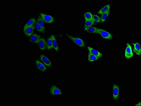 MAPT / Tau Antibody - Immunofluorescent analysis of HepG2 cells using MAPT Antibody at a dilution of 1:100 and Alexa Fluor 488-congugated AffiniPure Goat Anti-Rabbit IgG(H+L)