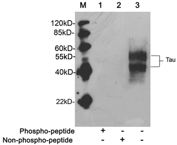 MAPT / Tau Antibody - Western blot of mouse brain tissue lysate using Rabbit Anti-Tau (Ab-217) Polyclonal Antibody Tau Antibody (Ab-217), pAb, Rabbit Lane 1: Rabbit Anti-Tau (Ab-217) Polyclonal Antibody pre-incubated with phospho-peptide Lane 2: Rabbit Anti-Tau (Ab-217) Polyclonal Antibody pre-incubated with non-phospho-peptide Lane 3: Rabbit Anti-Tau (Ab-217) Polyclonal Antibody Secondary Antibody: Goat Anti-Rabbit IgG (H&L) [HRP] Polyclonal Antibody The signal was developed with LumiSensor HRP Substrate Kit