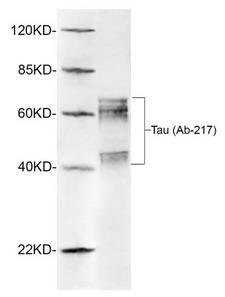 MAPT / Tau Antibody - Western blot of rat brain lysates using 1 ug/ml Rabbit Anti-Tau (Ab-217) Polyclonal Antibody Tau Antibody (Ab-217), pAb, Rabbit The signal was developed with IRDye 800 Conjugated Goat Anti-Rabbit IgG.