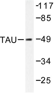 MAPT / Tau Antibody - Western blot of Tau (K225) pAb in extracts from MDA-MB-435 cells.