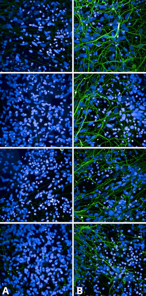 MAPT / Tau Antibody - Immunocytochemistry/Immunofluorescence analysis using Rabbit Anti-Tau Monoclonal Antibody, Clone AH36. Tissue: iPSC-derived cortical excitatory neurons. Species: Human. Primary Antibody: Rabbit Anti-Tau Monoclonal Antibody at 1:500 for Overnight. Secondary Antibody: Donkey anti-rabbit: Alexa Fluor 488 at 1:1000. Counterstain: DAPI. A) iPSC-derived neurons from non-demented control (NDC). B) iPSC-derived neurons from subject with P301L MAPT mutation. Images acquired using an automated Opera Phoenix system. Each field of view is a max projection from 10 planes of 1 µm stacks. Courtesy of: Francesco Paonessa.