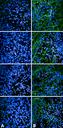 MAPT / Tau Antibody - Immunocytochemistry/Immunofluorescence analysis using Rabbit Anti-Tau Monoclonal Antibody, Clone AH36. Tissue: iPSC-derived cortical excitatory neurons. Species: Human. Primary Antibody: Rabbit Anti-Tau Monoclonal Antibody at 1:500 for Overnight. Secondary Antibody: Donkey anti-rabbit: Alexa Fluor 488 at 1:1000. Counterstain: DAPI. A) iPSC-derived neurons from non-demented control (NDC). B) iPSC-derived neurons from subject with P301L MAPT mutation. Images acquired using an automated Opera Phoenix system. Each field of view is a max projection from 10 planes of 1 µm stacks. Courtesy of: Francesco Paonessa.