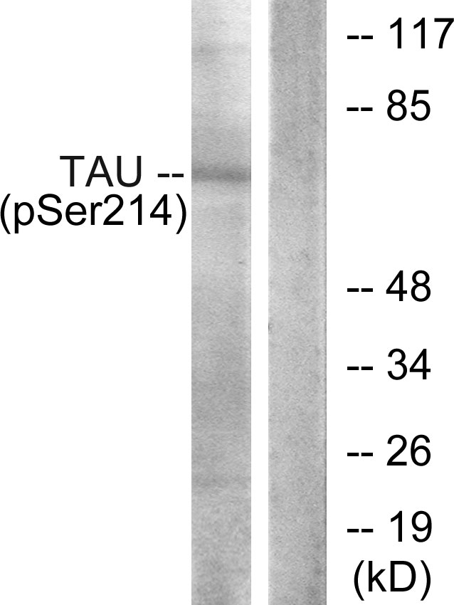 MAPT / Tau Antibody - Western blot analysis of lysates from HeLa cells, using Tau (Phospho-Ser214) Antibody. The lane on the right is blocked with the phospho peptide.