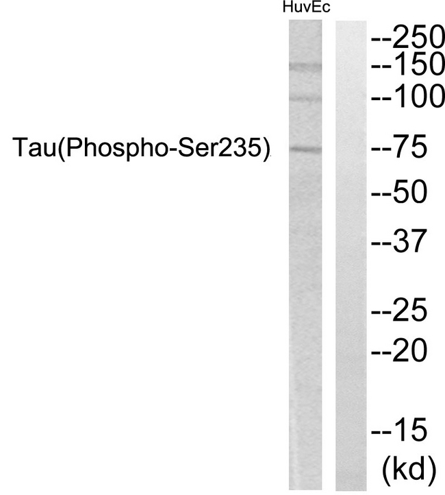 MAPT / Tau Antibody - Western blot analysis of lysates from HUVEC cells, using Tau (Phospho-Ser235) Antibody. The lane on the right is blocked with the phospho peptide.