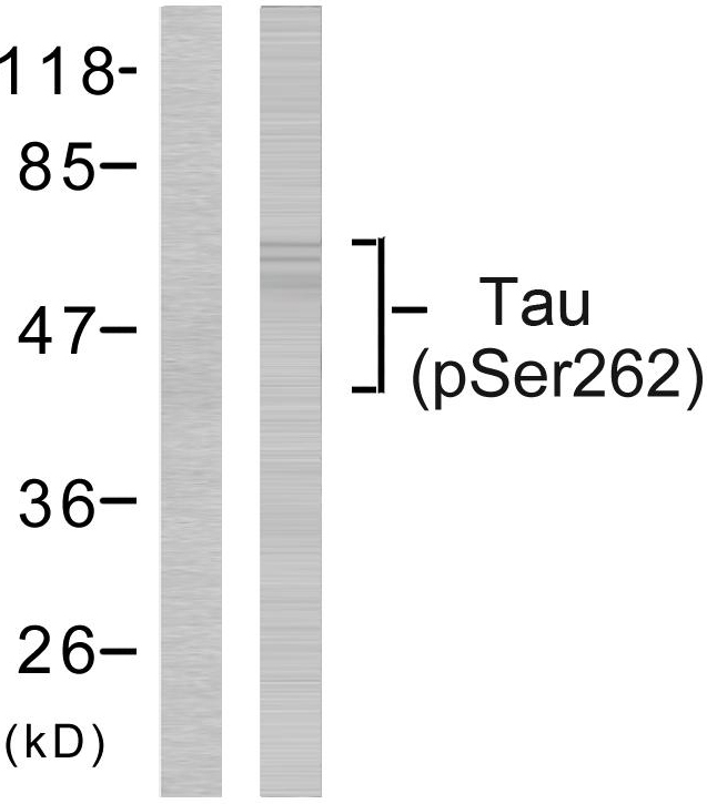 MAPT / Tau Antibody - Western blot analysis of lysates from HeLa cells, using Tau (Phospho-Ser262) Antibody. The lane on the left is blocked with the phospho peptide.
