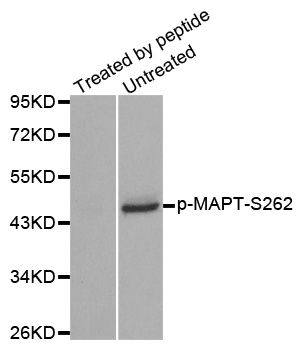 MAPT / Tau Antibody - Western blot analysis of extracts from mouse brain tissue.