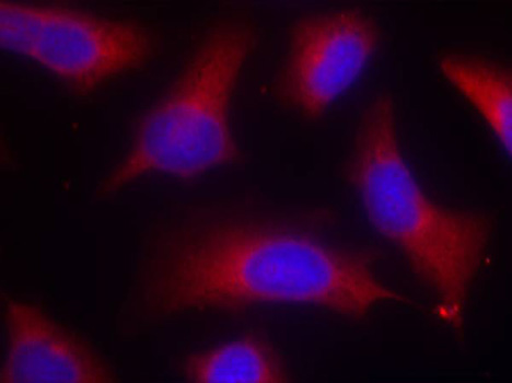MAPT / Tau Antibody - Immunofluorescence staining of methanol-fixed Hela cells.