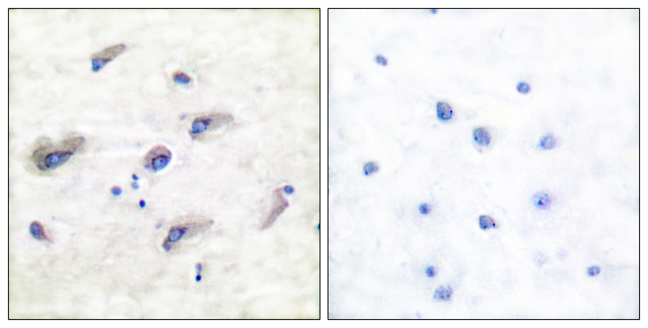 MAPT / Tau Antibody - Immunohistochemistry analysis of paraffin-embedded human brain, using Tau (Phospho-Ser356) Antibody. The picture on the right is blocked with the phospho peptide.