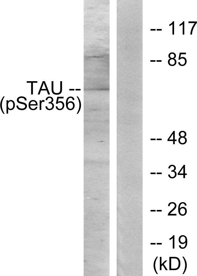 MAPT / Tau Antibody - Western blot analysis of lysates from 293 cells treated with serum 10% 15', using Tau (Phospho-Ser356) Antibody. The lane on the right is blocked with the phospho peptide.