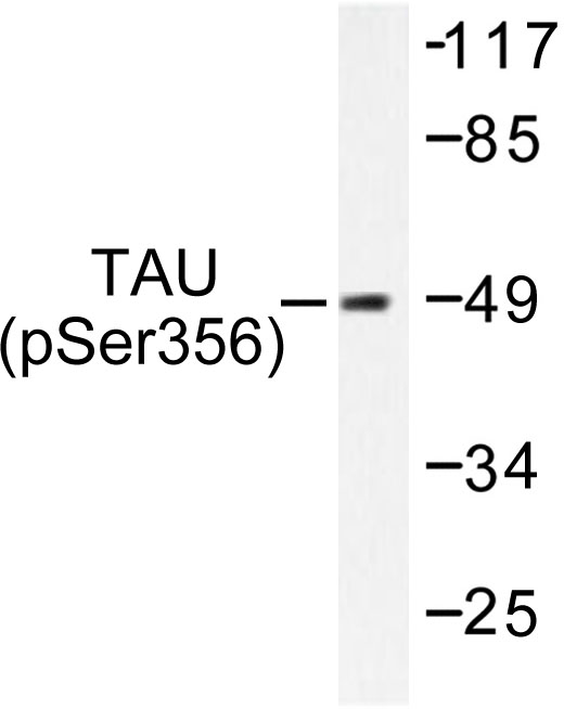 MAPT / Tau Antibody - Western blot of p-Tau (S356) pAb in extracts from 293 cells treated with serum 10% 15'.