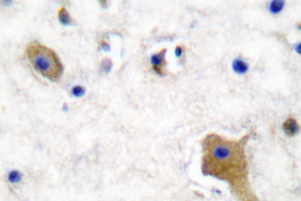 MAPT / Tau Antibody - IHC of p-Tau (S356) pAb in paraffin-embedded human brain tissue.