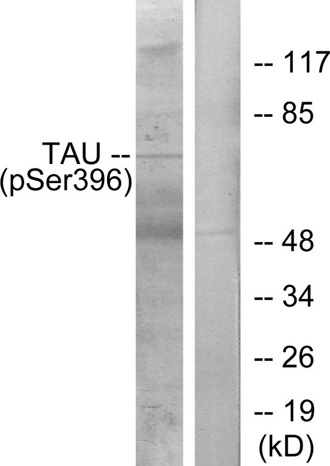 MAPT / Tau Antibody - Western blot analysis of lysates from HeLa cells, using Tau (Phospho-Ser396) Antibody. The lane on the right is blocked with the phospho peptide.