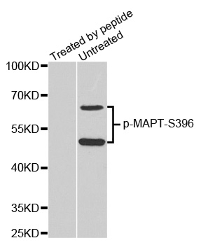 MAPT / Tau Antibody - Western blot analysis of extracts from mouse brain tissue.