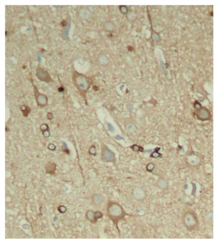 MAPT / Tau Antibody - Immunohistochemical analysis of paraffin-embedded rat hippocampal region tissue from a model with Alzheimer.