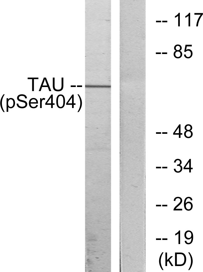 MAPT / Tau Antibody - Western blot analysis of lysates from 293 cells treated with UV, using Tau (Phospho-Ser404) Antibody. The lane on the right is blocked with the phospho peptide.