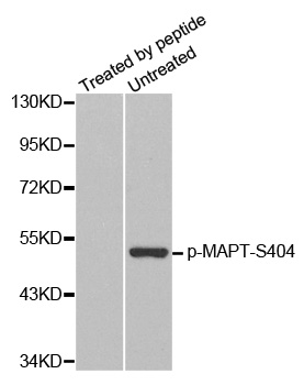 MAPT / Tau Antibody - Western blot analysis of extracts from mouse brain tissue.