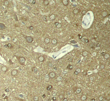 MAPT / Tau Antibody - Immunohistochemical analysis of paraffin-embedded rat hippocampal region tissue from a model with Alzheimer.