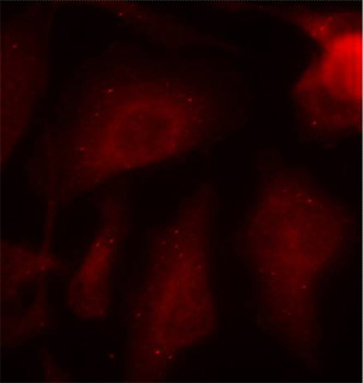 MAPT / Tau Antibody - Immunofluorescence staining of methanol-fixed Hela cells.