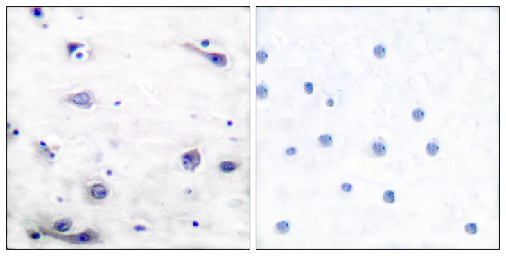 MAPT / Tau Antibody - Immunohistochemistry analysis of paraffin-embedded human brain, using Tau (Phospho-Ser422) Antibody. The picture on the right is blocked with the phospho peptide.