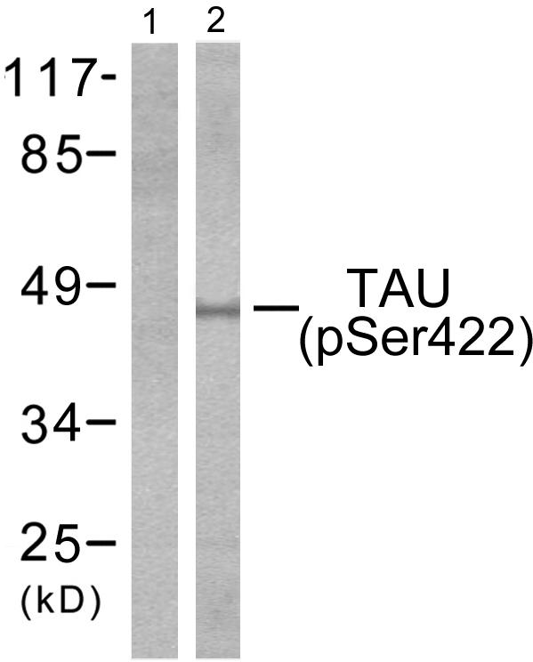 MAPT / Tau Antibody - Western blot analysis of lysates from mouse brain, using Tau (Phospho-Ser422) Antibody. The lane on the left is blocked with the phospho peptide.