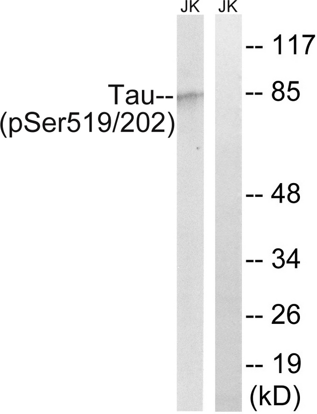 MAPT / Tau Antibody - Western blot analysis of lysates from Jurkat cells treated with H2O2 100uM 30', using Tau (Phospho-Ser519/202) Antibody. The lane on the right is blocked with the phospho peptide.