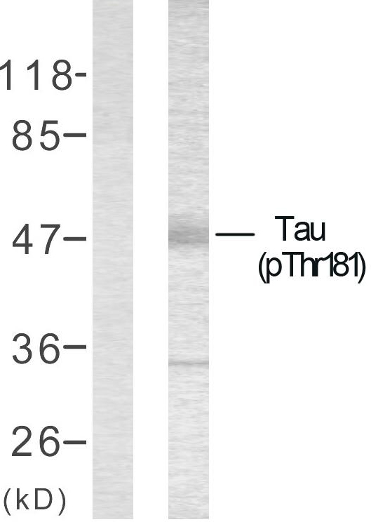 MAPT / Tau Antibody - Western blot analysis of lysates from mouse brain, using Tau (Phospho-Thr181) Antibody. The lane on the left is blocked with the phospho peptide.