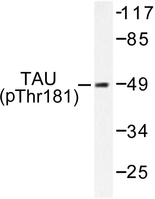 MAPT / Tau Antibody - Western blot of p-Tau (T181) pAb in extracts from mouse brain.
