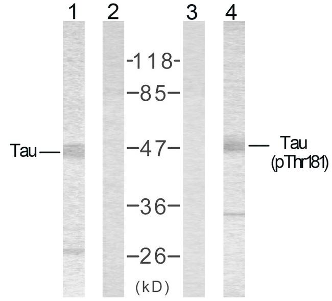 MAPT / Tau Antibody - Western blot analysis of extracts from mouse brain tissue using Tau (Ab-181) Antibody and Tau (Phospho-Thr181) Antibody.