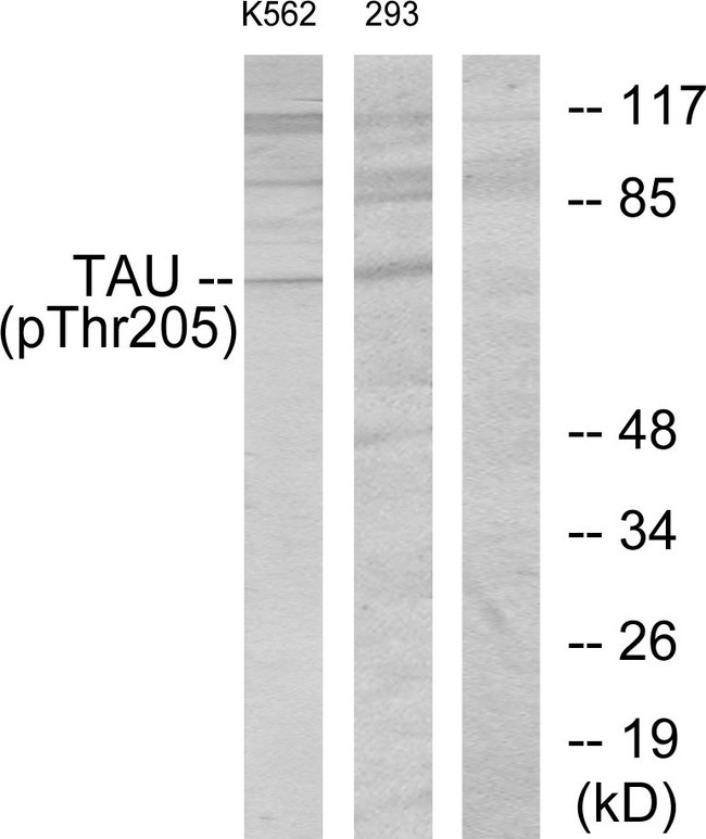 MAPT / Tau Antibody - Western blot analysis of lysates from K562 cells and 293 cells, using Tau (Phospho-Thr205) Antibody. The lane on the right is blocked with the phospho peptide.