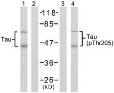 MAPT / Tau Antibody - Western blot analysis of extracts from mouse brain tissue using Tau (Ab-205) antibody (Line 1 and 2) and Tau (phospho- Thr205) antibody (Line 3 and 4).