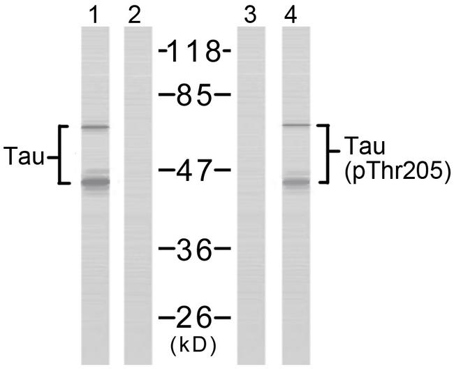 MAPT / Tau Antibody - Western blot analysis of extracts from mouse brain tissue using Tau (Ab-205) antibody (Line 1 and 2) and Tau (phospho- Thr205) antibody (Line 3 and 4).