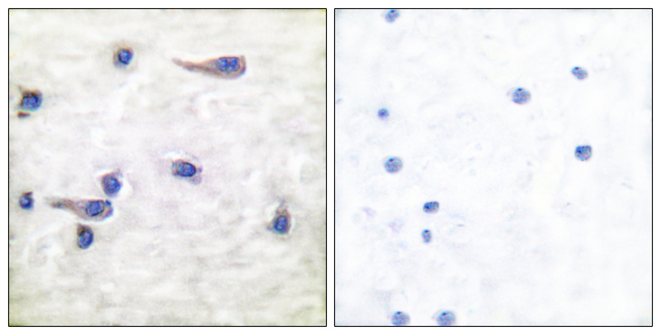 MAPT / Tau Antibody - Immunohistochemistry analysis of paraffin-embedded human brain, using Tau (Phospho-Thr212) Antibody. The picture on the right is blocked with the phospho peptide.