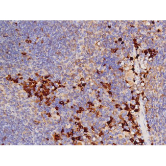 MAPT / Tau Antibody - 1:200 staining mouse spleen tissue by IHC-P. The tissue was formaldehyde fixed and a heat mediated antigen retrieval step in citrate buffer was performed. The tissue was then blocked and incubated with the antibody for 1.5 hours at 22°C. An HRP conjugated goat anti-rabbit antibody was used as the secondary.