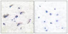 MAPT / Tau Antibody - P-peptide - + Immunohistochemical analysis of paraffin-embedded human brain tissue using Tau (phospho-Ser356) antibody.