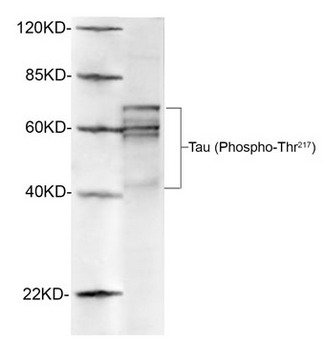 MAPT / Tau Antibody - Western blot of rat brain lysates using 1 ug/ml Rabbit Anti-Tau (Phospho-Thr217) Polyclonal Antibody. The signal was developed with IRDye 800 Conjugated Goat Anti-Rabbit IgG.