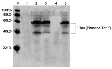 MAPT / Tau Antibody - Western blot of mouse brain tissue lysate using Rabbit Anti-Tau (Phospho-Thr217) Polyclonal Antibody. Lane 1: Primary antibody negative control. Lane 2: Rabbit Anti-Tau (Phospho-Thr217) Polyclonal Antibody. Lane 3: Rabbit Anti-Tau (Phospho-Thr217) Polyclonal Antibody pre-incubated with non-phospho-peptide. Lane 4: Rabbit Anti-Tau (Phospho-Thr217) Polyclonal Antibody pre-incubated with phoshpo-peptide. Lane 5: Rabbit Anti-Tau (Phospho-Thr217) Polyclonal Antibody pre-incubated with generic phospho-threonine containing peptide. Secondary antibody: Goat Anti-Rabbit IgG (H&L) [HRP] Polyclonal Antibody.
