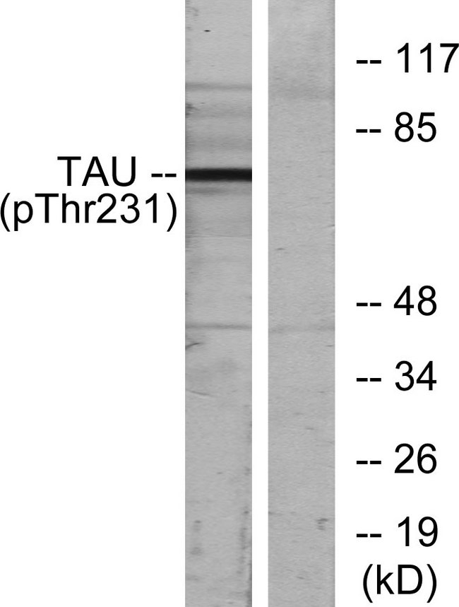 MAPT / Tau Antibody - Western blot analysis of lysates from MDA-MB-435 cells, using Tau (Phospho-Thr231) Antibody. The lane on the right is blocked with the phospho peptide.