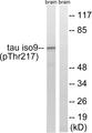 MAPT / Tau Antibody - Western blot analysis of extracts from rat brain cells, using Tau (Phospho-Thr534/217) antibody.