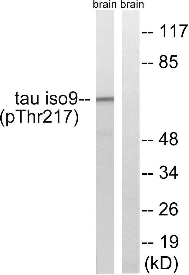 MAPT / Tau Antibody - Western blot analysis of lysates from rat brain, using Tau (Phospho-Thr534/217) Antibody. The lane on the right is blocked with the phospho peptide.